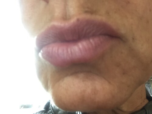 Attach12832 20170214 101301